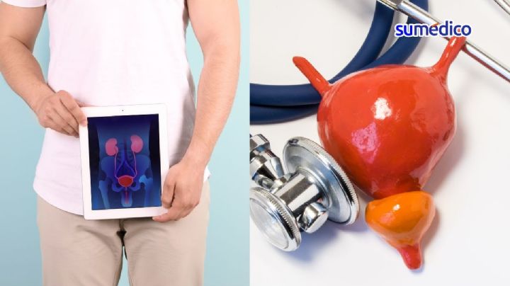 ¿Qué alimentos empeoran la próstata inflamada?
