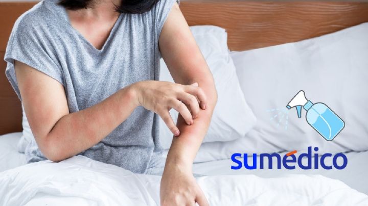 ¿Qué olor odian los insectos de cama? Así prepara tu repelente casero