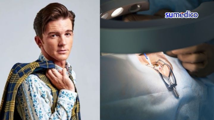 ¿En qué consiste la cirugía de ojos LASIK como la de Drake Bell?