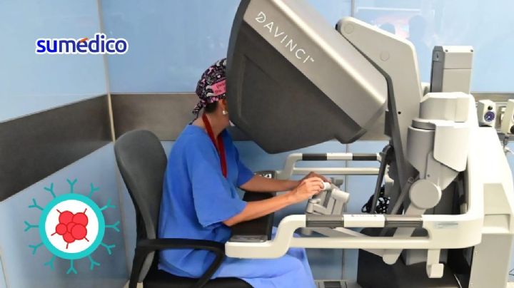 Cirugía Robótica: Así mejora la precisión y recuperación del cáncer