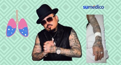 ¿Qué causa el líquido en los pulmones como le pasó a A.B Quintanilla?