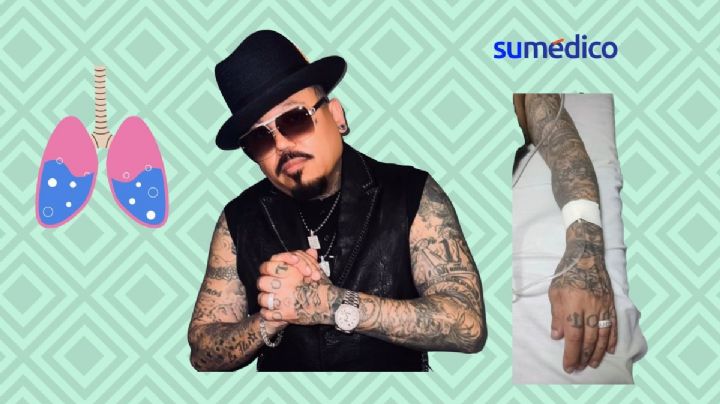 ¿Qué causa el líquido en los pulmones como le pasó a A.B Quintanilla?