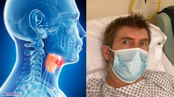 “Creí que era un simple dolor de garganta, pero resultó ser cáncer de cabeza y cuello”