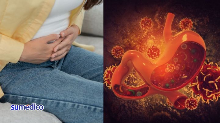¿Qué síntomas da el cáncer de estómago? 5 señales que NO debes ignorar