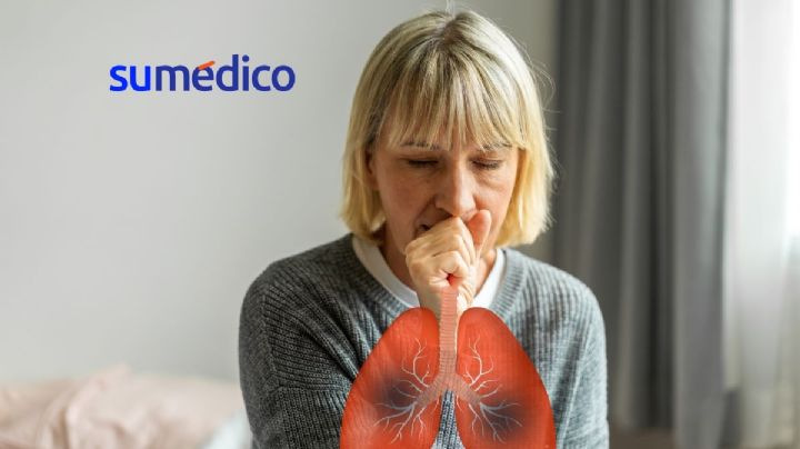¿Qué síntomas da el cáncer de pulmón? 5 señales que NO debes ignorar