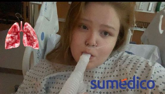 ‘Cambié el cigarro por vape, ahora tengo una rara enfermedad pulmonar’