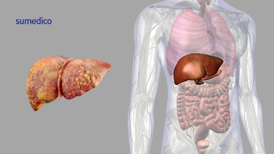 Un estudio colaborativo internacional ha identificado a la proteína E2F2 como una posible nueva diana terapéutica