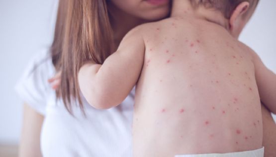 Coberturas de vacunación a la baja en México: La amenaza del resurgimiento de enfermedades