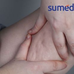 5 prácticas que aumentan la aparición de celulitis en la piel