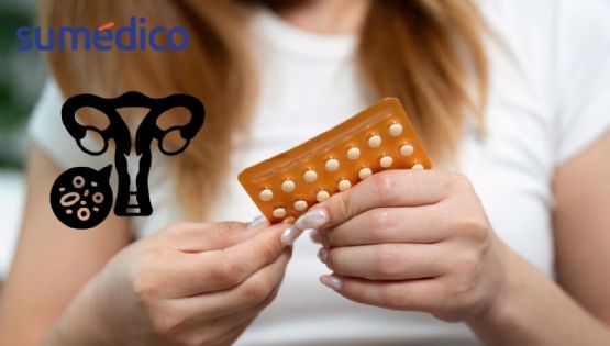 La píldora anticonceptiva femenina puede causar cáncer, TODO lo que debes saber