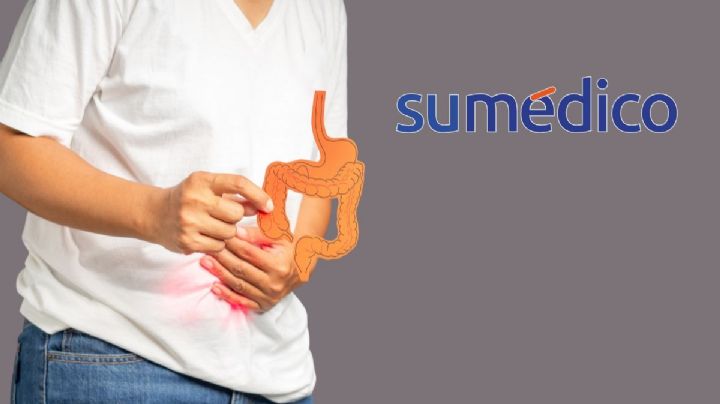 ¿Qué es la colitis y cuáles son sus síntomas?