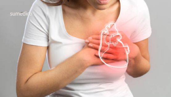 ¿Cuáles son los síntomas de infarto en mujeres de 40 a 50 años?