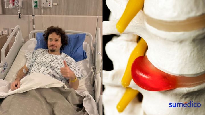 ¿Por qué salen hernias de disco como a Luisito Comunica?