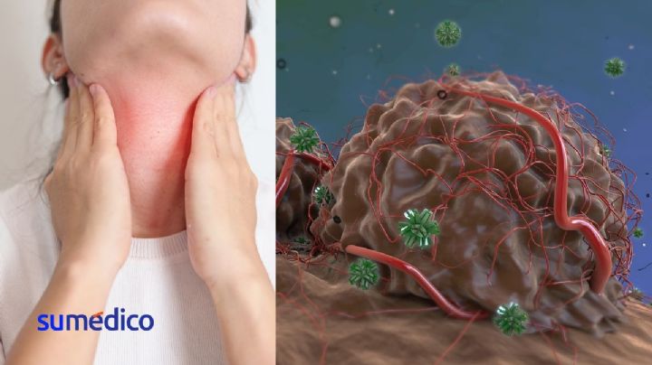 'El cáncer muy temprano es poco probable que dé síntomas': Oncóloga dice cómo prevenir