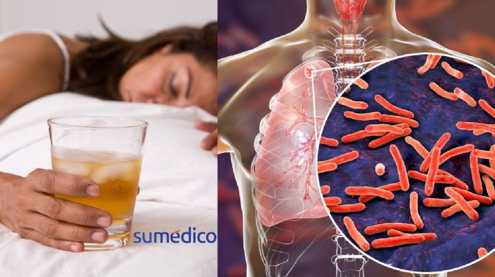 Consumo de alcohol, una causa poco conocida de tuberculosis