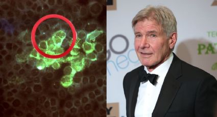 ¿Qué es el herpes zóster por el que Harrison Ford no pudo asistir a los Oscar?