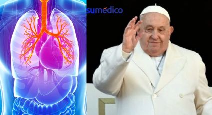 Insuficiencia respiratoria aguda, nueva complicación del Papa Francisco ¿Qué es?