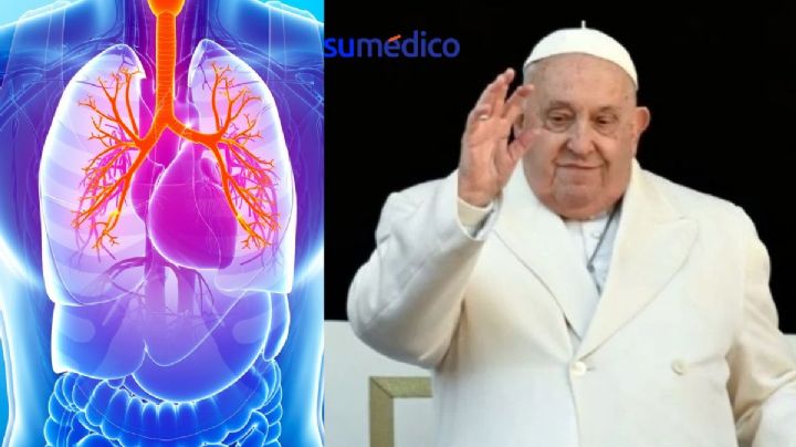 Insuficiencia respiratoria aguda, nueva complicación del Papa Francisco ¿Qué es?