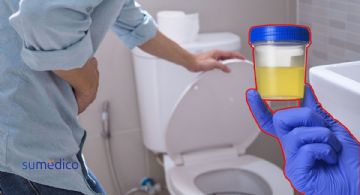 ¿Cómo se ve la orina cuando hay diabetes? 5 señales que NO debes ignorar