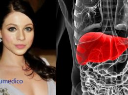 ¿De qué murió Michelle Trachtenberg? Revelan la grave enfermedad que padeció