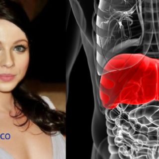 ¿De qué murió Michelle Trachtenberg? Revelan la grave enfermedad que padeció