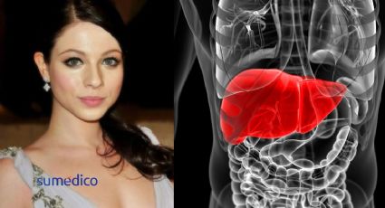 ¿De qué murió Michelle Trachtenberg? Revelan la grave enfermedad que padeció