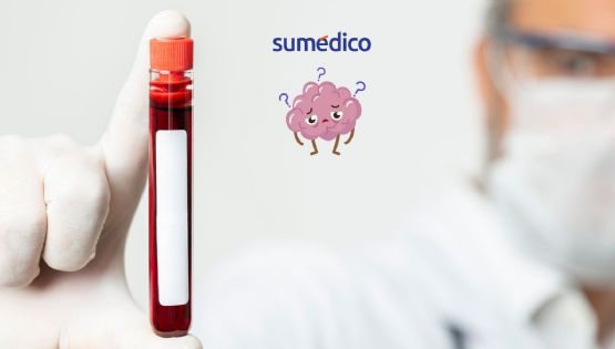 Detectar alzhéimer con una muestra de sangre ya es posible