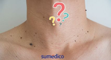 ¿Por qué aparecen verrugas en el cuello, debo preocuparme?