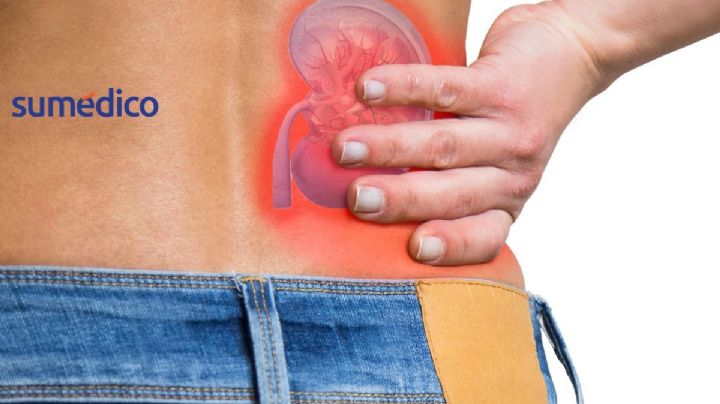 5 prácticas que son peligrosas para los riñones