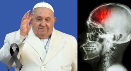 ¿Qué causa un derrame, motivo confirmado de la muerte del Papa Francisco?