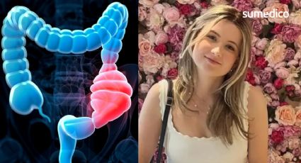 Dominique McShain: ¿Qué causa un cáncer de colon a los 21 años como el que padeció?