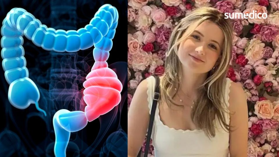 Dominique McShain fue diagnosticada con un agresivo cáncer de colon a los 21 años.