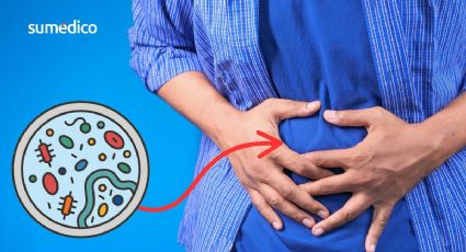 ¿Tuviste esta infección en la infancia? Podrías tener más riesgo de cáncer de colon precoz