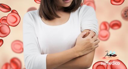 ¿Qué es el paludismo y qué síntomas da? 5 señales que NO debes ignorar
