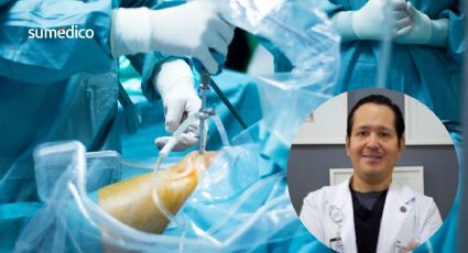 Mitos sobre la cirugía de rodilla