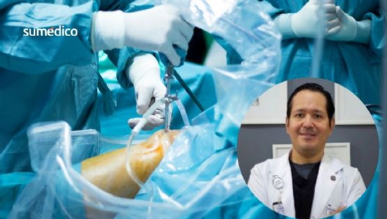 Mitos sobre la cirugía de rodilla