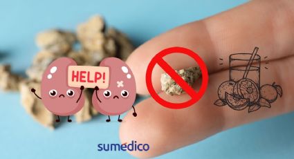 ¿Quieres prevenir los cálculos renales? Este es el jugo que debes tomar