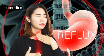 ¿Tienes reflujo? Cuidado, podría ser esta enfermedad