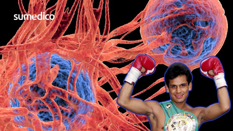 El boxeador mexicano enfrentó con valentía esta grave enfermedad.