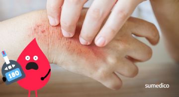 ¿Tu piel muestra estas señales de alerta? Podría ser diabetes