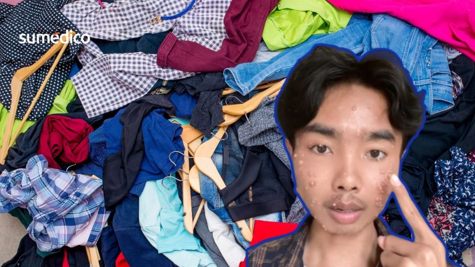 La ropa usada o 'de paca' puede tener virus y bacterias peligrosos.