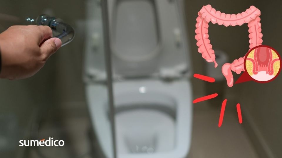 Sin darte cuenta, podrías estar causando hemorroides cada vez que vas al baño.