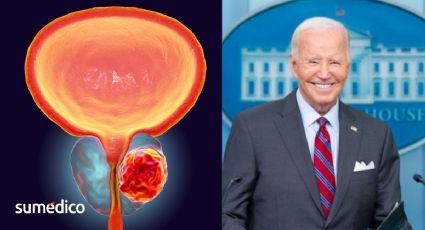 ¿Qué causa el cáncer de próstata y metástasis que sufre Joe Biden?