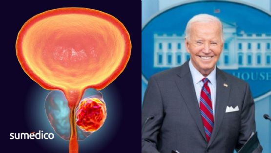 ¿Qué causa el cáncer de próstata y metástasis que sufre Joe Biden?