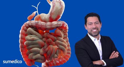 ¿Diarrea frecuente? Experto revela qué enfermedad podrías tener