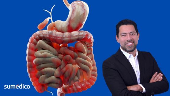 ¿Diarrea frecuente? Experto revela qué enfermedad podrías tener