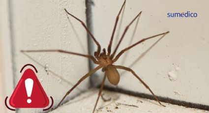 ¿Cómo reconocer una mordedura de araña violinista y qué hacer?