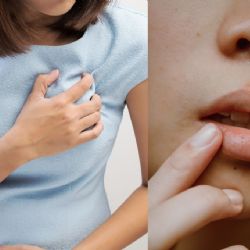El síntoma en los labios que podría alertar una enfermedad cardiaca