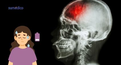 ¿Fatiga constante? Podrías haber sufrido un mini derrame cerebral