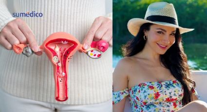 ¿Qué síntomas dan los miomas uterinos como los que le quitaron a Martha Higareda?